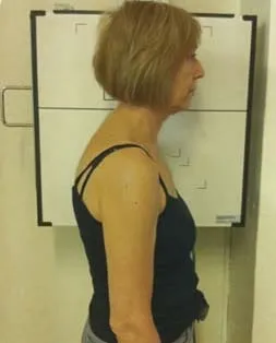 spinal-health-care3a spinal health care case study