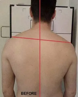 chiropractic-spinal-health-case-study2a chiropractic spinal health case study