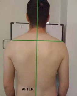 chiropractic-spinal-health-case-study2b chiropractic spinal health cheam